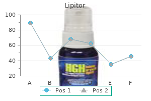 cheap lipitor 40 mg with mastercard